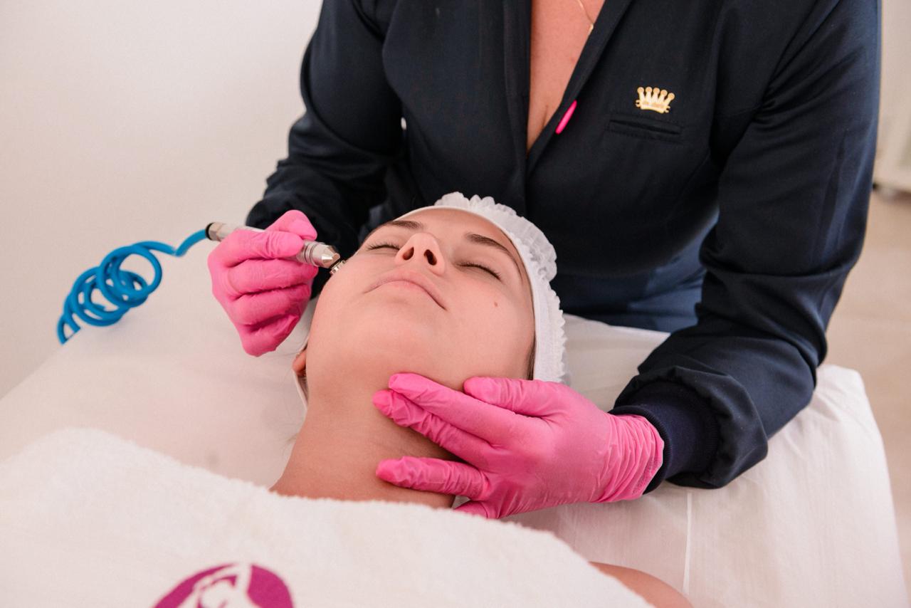 Peeling de Diamante e Químico em Santos